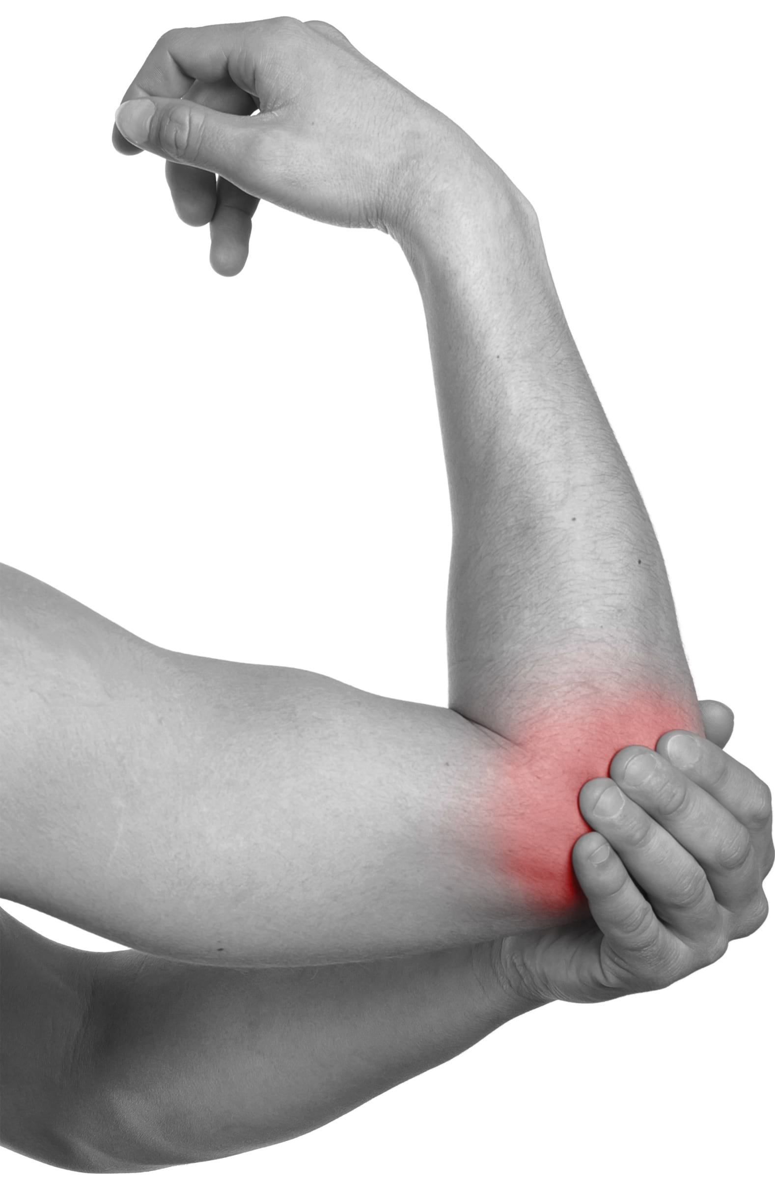 Musarm/tennisarmbåge
